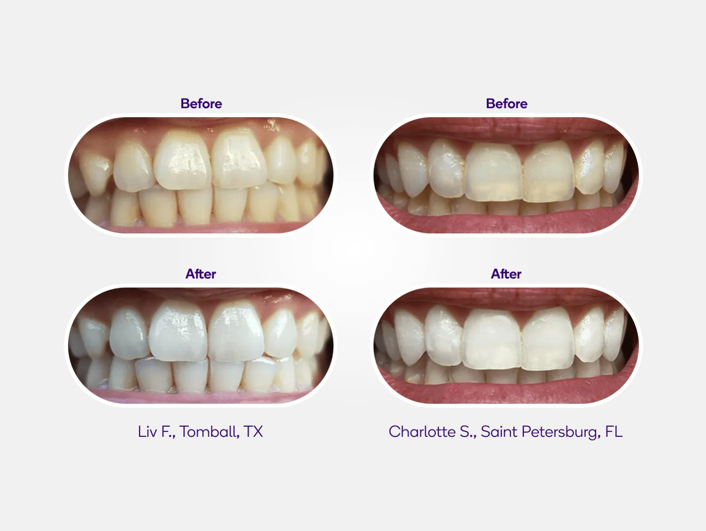 Mint Non-Slip Whitening Strips Refill - Image 5