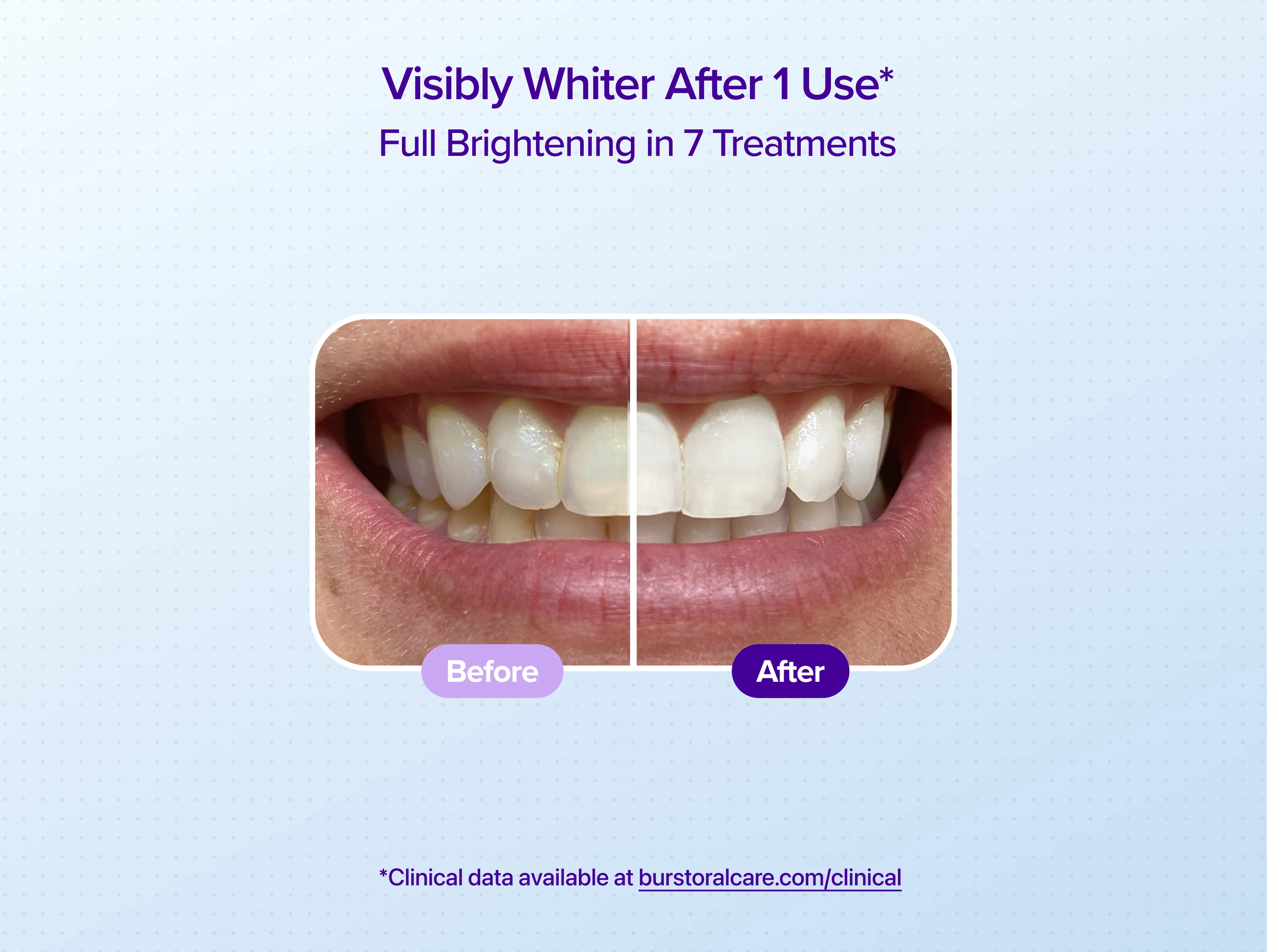 Watermelon Non-Slip Whitening Strips - Image 3